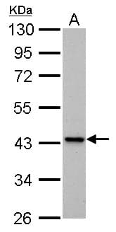 Polyclonal Rabbit anti-Human IVD Antibody (aa1-222, IHC, WB)