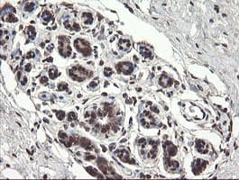 Monoclonal Mouse anti-Human PNPO Antibody (clone OTI1G9, IHC, WB)