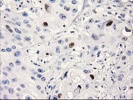 Monoclonal Mouse anti-Human TP53 / p53 Antibody (clone OTI3F5, IHC, IF, WB)
