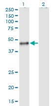 CALU / Calumenin Antibody (clone 6C8)
