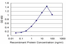ROBO1 Antibody (clone 1F8)