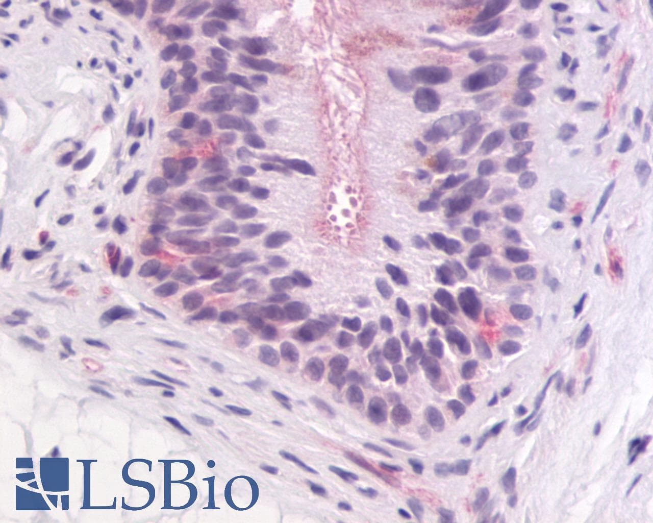 IHC-plus™ Polyclonal Rabbit anti-Human ADGRG2 / GPR64 Antibody (C-Terminus, IHC)