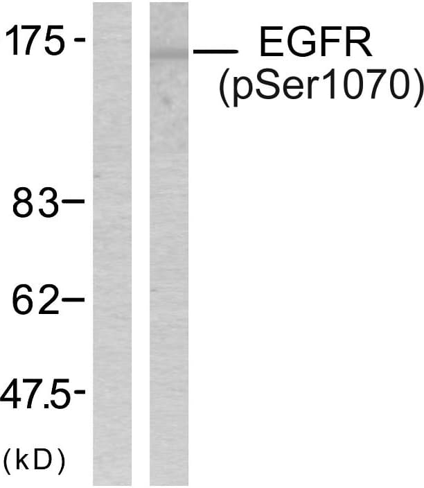 Polyclonal Rabbit anti-Human EGFR Antibody (phospho-Ser1070, IHC, WB)