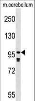 PDE4A / PDE4 Antibody (aa32-61)