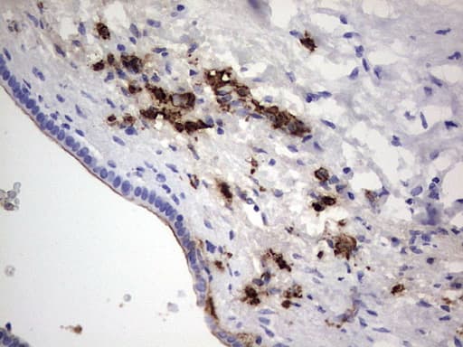 S100A9 / MRP14 Antibody (clone OTI7B1)