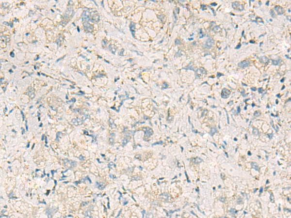 WDR37 Antibody