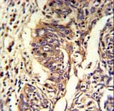 KYNU Antibody (aa359-386)