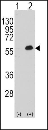 MEF2C Antibody (Thr300)