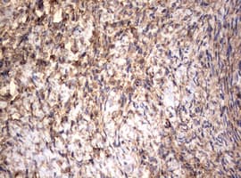 Vimentin Antibody (clone OTI1A9)