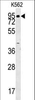 AOC1 Antibody (aa71-100)