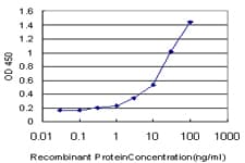 IHC-plus™ SPP1 / Osteopontin Antibody (clone X1)