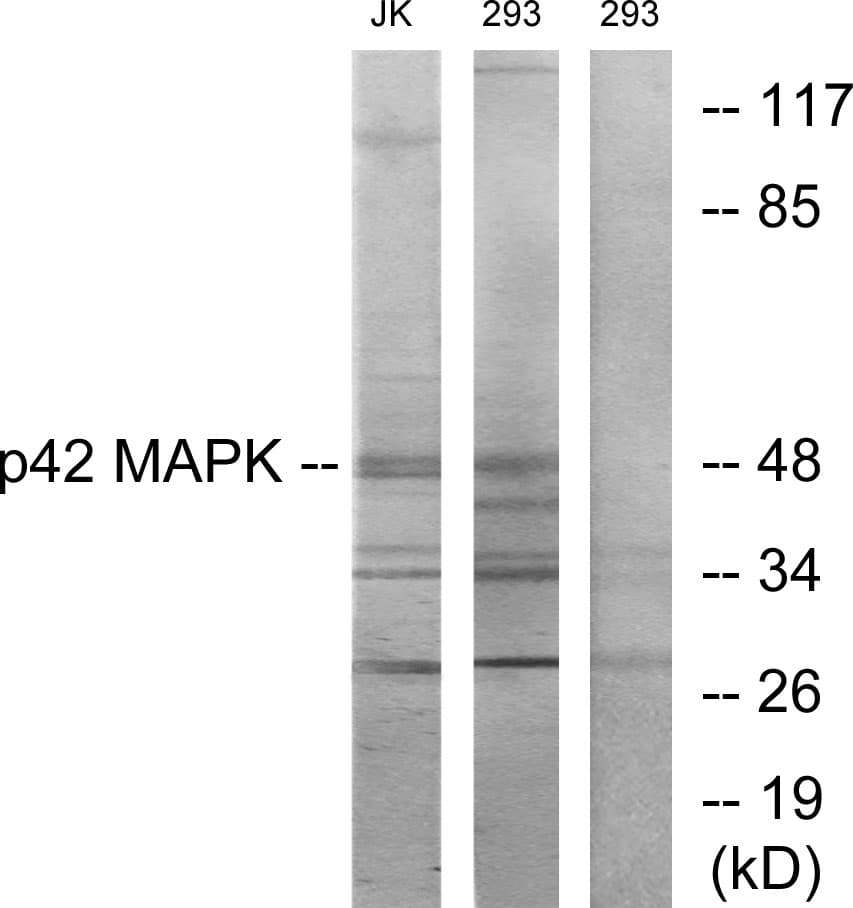 MAPK1 / ERK2 Antibody (aa136-185)