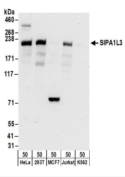 IHC-plus™ SIPA1L3 Antibody (aa1-50)