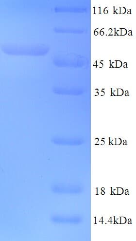 Human HPV18 L2 Protein (Recombinant 6His, N-terminus)