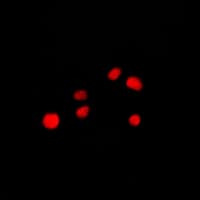 NUP160 Antibody (Internal)