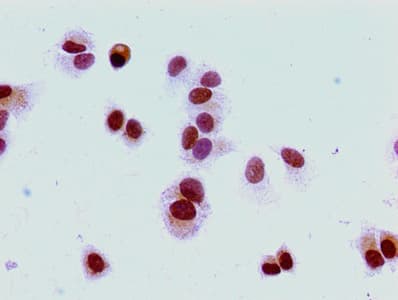 HIST1H1E Antibody