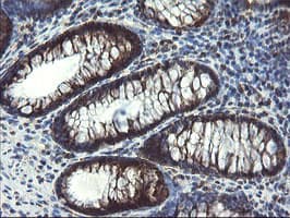 SKIL / SNO / SnoN Antibody (clone OTI3F6)