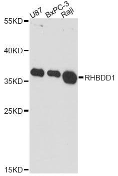 Polyclonal Rabbit anti-Human RHBDD1 Antibody (WB)