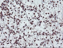 EXOSC7 Antibody (clone OTI1G8)