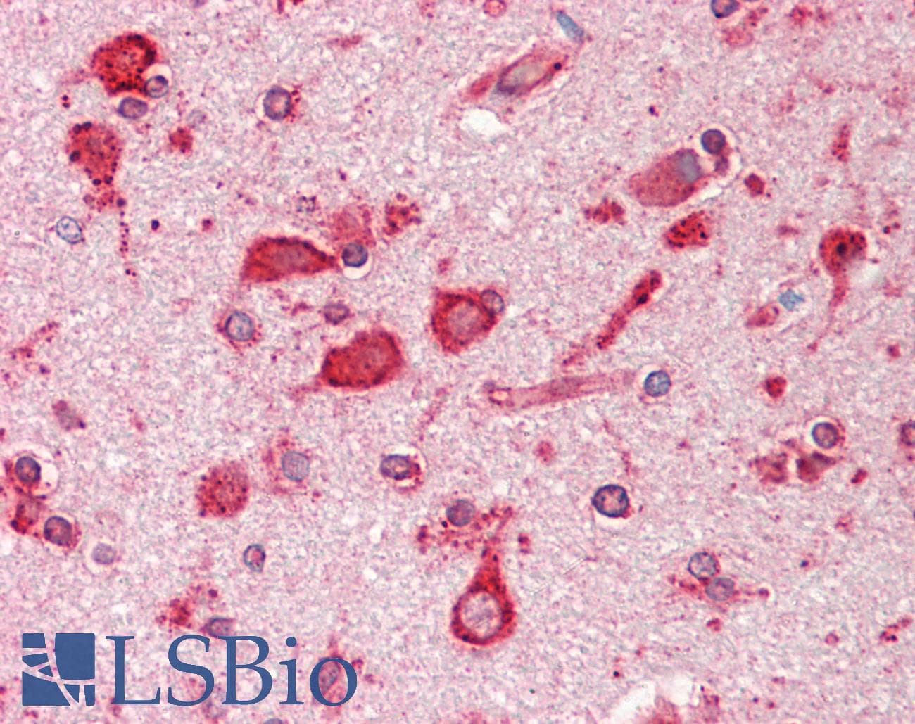 IHC-plus™ HSPA5 / GRP78 / BiP Antibody (aa645-654)
