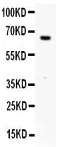 ER Alpha / Estrogen Receptor Antibody (aa425-595)