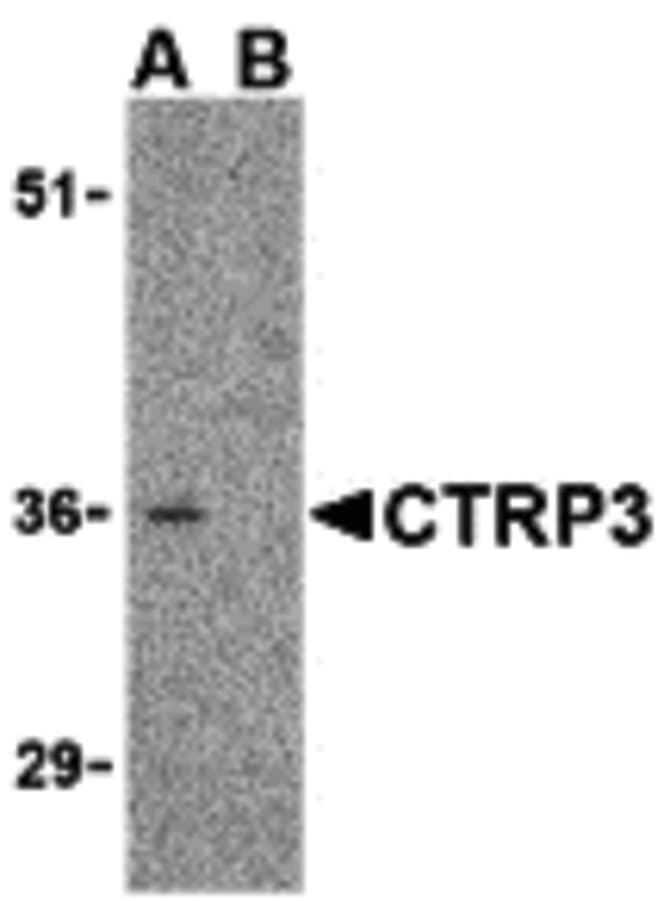 IHC-plus™ C1QTNF3 / CTRP3 Antibody