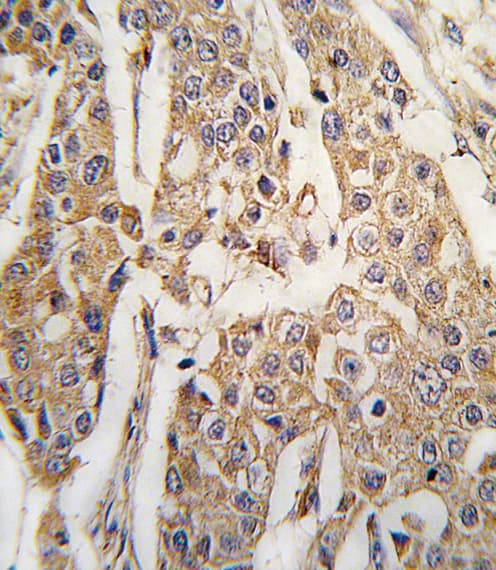 PKM / Pyruvate Kinase, Muscle Antibody (aa460-489)