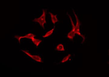 Polyclonal Rabbit anti-Human SLC4A11 / NABC1 Antibody (IF, WB)