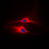 p56lck / LCK Antibody (Internal)