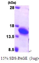 Human PFN2 / Profilin 2 Protein (Recombinant His)