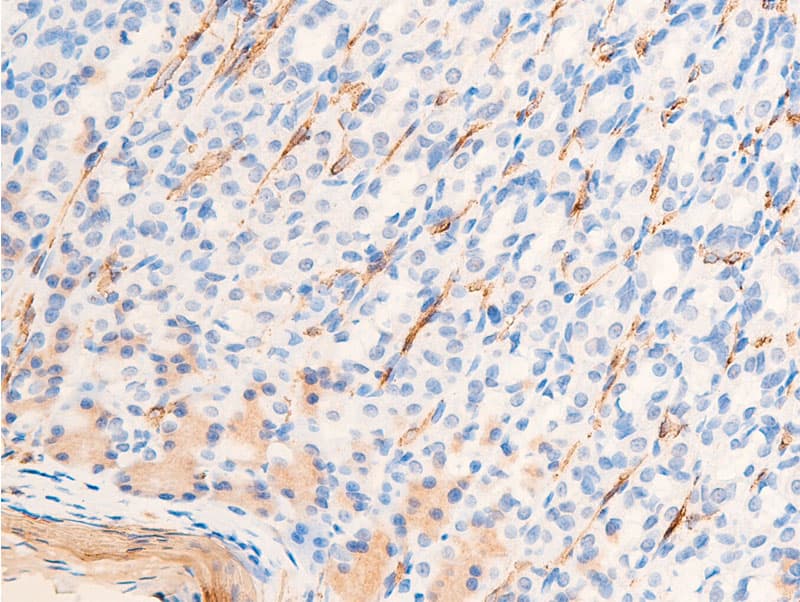 ACTA2 / Smooth Muscle Actin Antibody