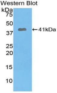 PYGO1 / Pygopus 1 Antibody (aa201-419)