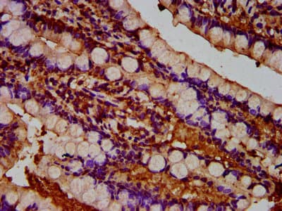 Polyclonal Rabbit anti-Human TUSC3 Antibody (IHC, WB)