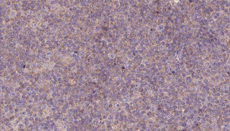Polyclonal Rabbit anti-Human PEG1 / MEST Antibody (IHC, IF, WB)