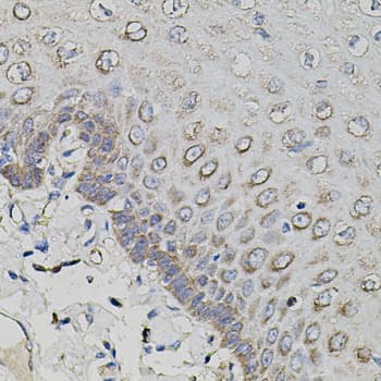 APP / Beta Amyloid Precursor Antibody