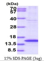 Human CENPH / CENP-H Protein (Recombinant His)