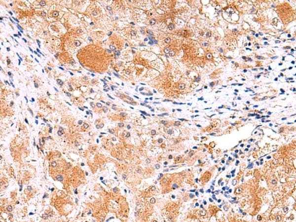 Polyclonal Rabbit anti-Human ITSN2 Antibody (IHC)