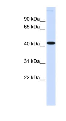 MSY2 / YBX2 Antibody (aa36-85)