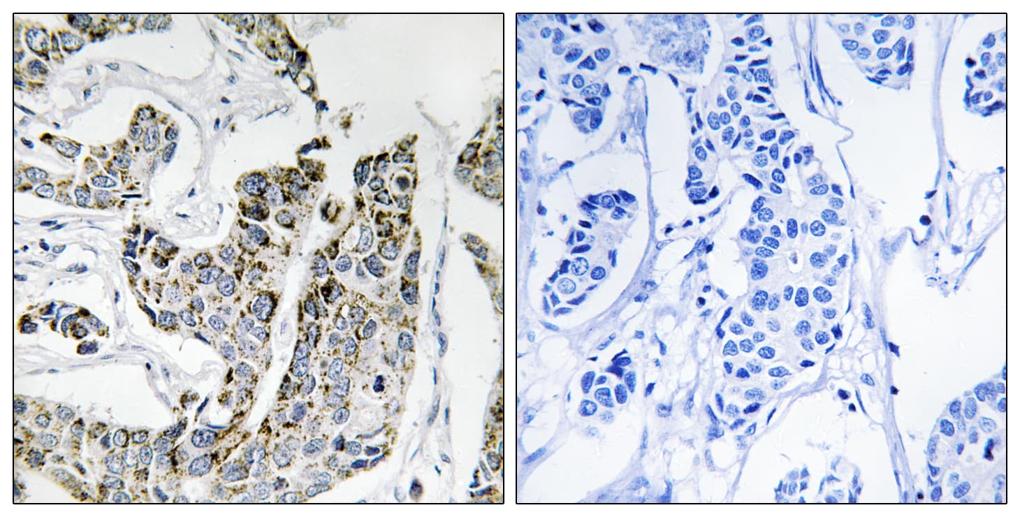 Polyclonal Rabbit anti-Human BLK Antibody (phospho-Tyr501, IHC)