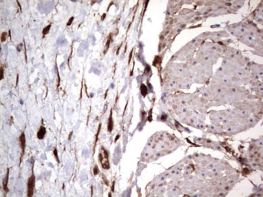 LGALS3 / Galectin 3 Antibody (clone UMAB157, Carrier-free)