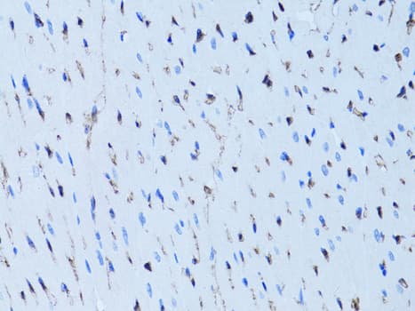 Polyclonal Rabbit anti-Human FABP4 / AP2 Antibody (IHC, IF, WB)
