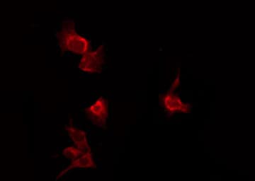 RAF1 / RAF Antibody