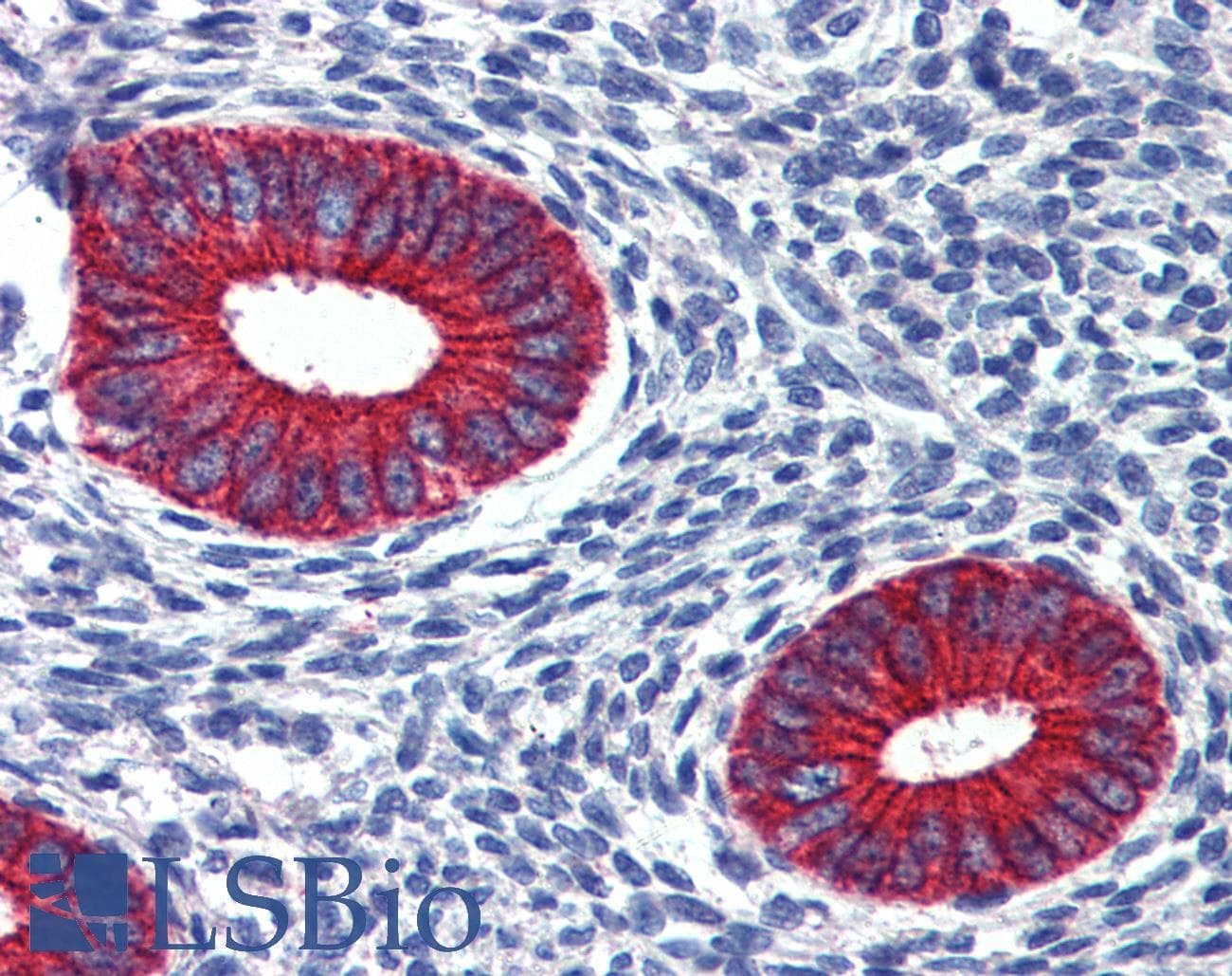 IHC-plus™ Polyclonal Goat anti-Human EPB41L2 Antibody (aa593-604, IHC, WB)