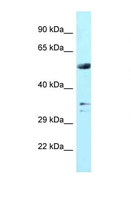 WDR54 Antibody (aa153-202)