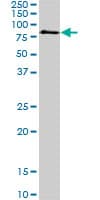 MECP2 Antibody (clone 1B11)