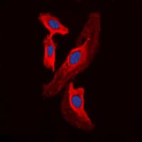 FHIT Antibody (Internal)