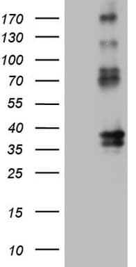Monoclonal Mouse anti-Human PROCR / EPCR Antibody (clone OTI12H5, aa1-210, IHC, WB)
