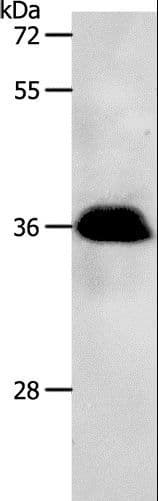 Polyclonal Rabbit anti-Human PP2CB / PPP2CB Antibody (IHC, WB)