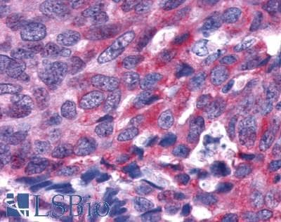 PathPlus™ FAK / Focal Adhesion Kinase Antibody (Internal)