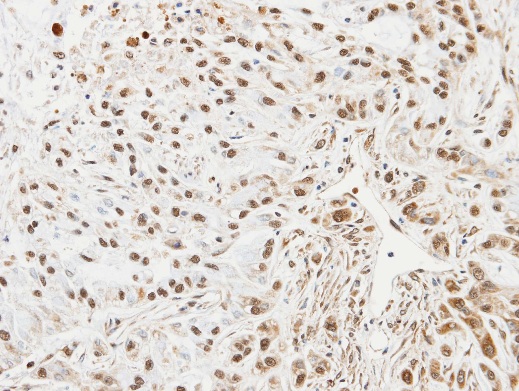 Polyclonal Rabbit anti-Human UBE2L3 / UBCH7 Antibody (aa92-154, IHC, WB)